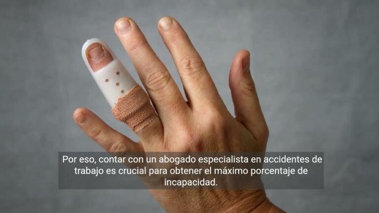 indemnizacion por perdida de un dedo en accidente laboral