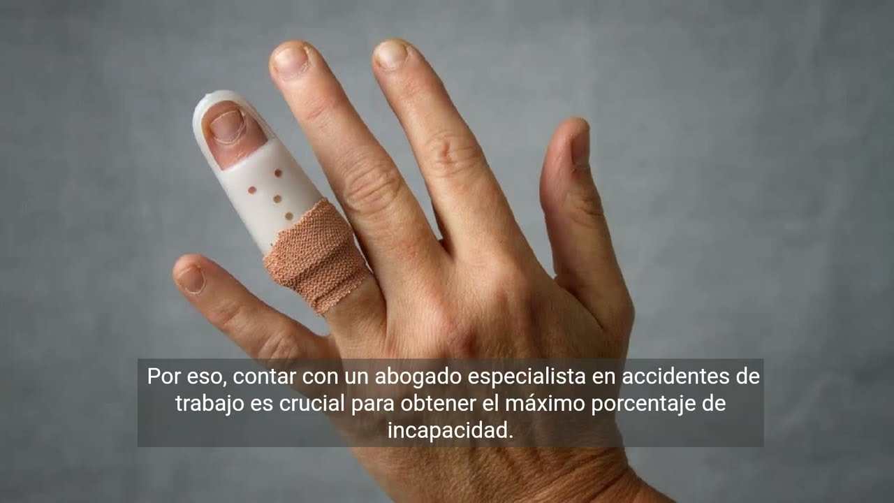 indemnizacion por perdida de un dedo en accidente laboral